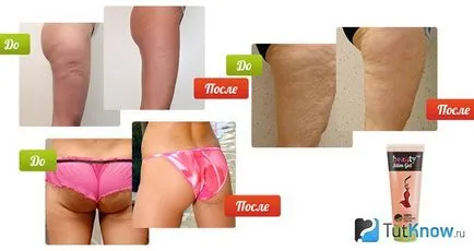Антицелюлітний крем-гель beauty slim gel ціна, відгуки (антицелюлітний крем-гель) Антицелюлітний крем-гель beauty slim gel ціна, відгуки