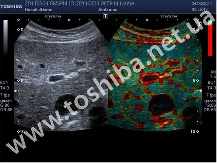 Апарат УЗД, ціна