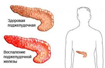 Болить живіт і кишечник після алкоголю причини, лікування (після) Болить живіт і кишечник після алкоголю причини, лікування