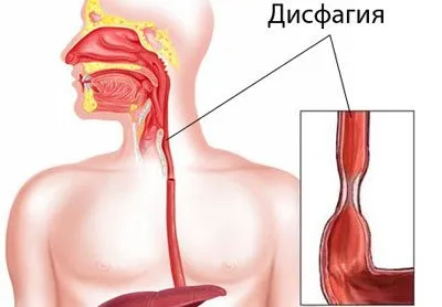 Болить живіт і кишечник після алкоголю причини, лікування (причини) Болить живіт і кишечник після алкоголю причини, лікування