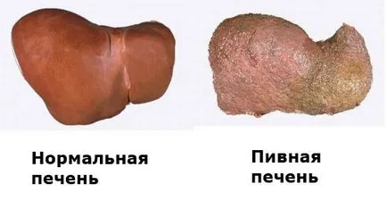 Болить живіт після пива причини і можливі захворювання (біль живіт пиво причини лікування) Болить живіт після пива причини і можливі захворювання