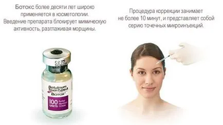 Ботокс наслідки, відгуки, за і проти, фото до і після (наслідки) Ботокс наслідки, відгуки, за і проти, фото до і після