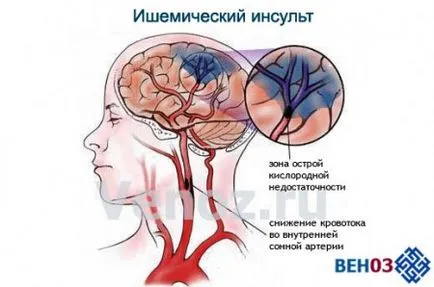 Хвороби голови і мозку (голови) Хвороби голови і мозку