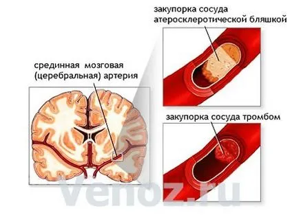 Хвороби голови і мозку (хвороби) Хвороби голови і мозку