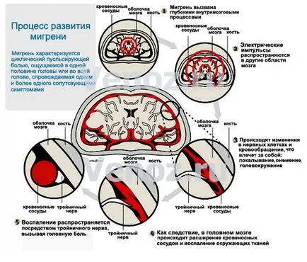 Хвороби голови і мозку (хвороби) Хвороби голови і мозку