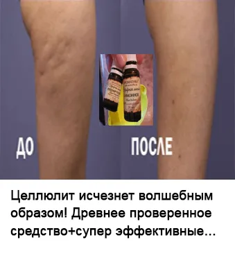 Будьте обережні, коли він болить у верхній лівій частині живота! Дивись повна карта болів в області