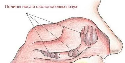 Чим небезпечний хропіння уві сні для здоров'я людини