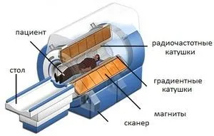 Що діагностує мрт головного мозку, черевної порожнини, хребта