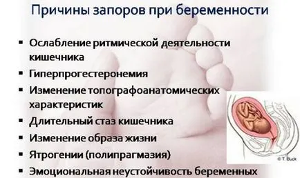 Чорнослив при запорах як вживати, користь для кишечника (запорах) Чорнослив при запорах як вживати, користь для кишечника