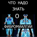 Що треба знати про фибромиалгии (треба) Що треба знати про фибромиалгии