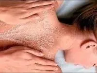 Що таке пілінг