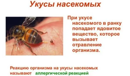 Що таке фонофорез з гідрокортизоном, протипоказання (гідрокортизоном) Що таке фонофорез з гідрокортизоном, протипоказання
