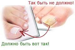 Деміктен лак від грибка нігтів відгуки, ціна і опис препарату (грибка) Деміктен лак від грибка нігтів відгуки, ціна і опис препарату