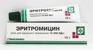 Еритразма хвороба людей із зайвою вагою, все про лікування (вагою) Еритразма хвороба людей із зайвою вагою, все про лікування