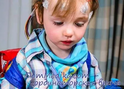 Фебрильні судоми у дітей