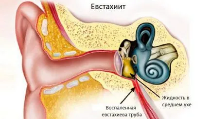 Гіпертрофічний риніт гострий і хронічний - симптоми і лікування у дорослих і дітей ліками, (дітей) Гіпертрофічний риніт гострий і хронічний - симптоми і лікування у дорослих і дітей ліками,