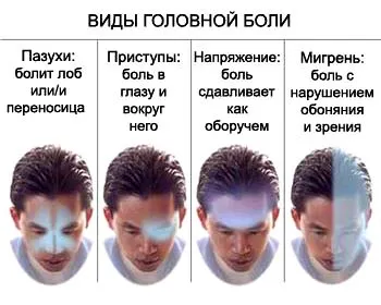 Головний біль