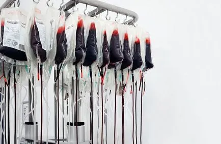 Група нуль, esquire