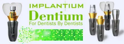Імпланти implantium установка, особливості, показання та протипоказання (implantium) Імпланти implantium установка, особливості, показання та протипоказання