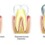 Исповедь вегетаріанця
