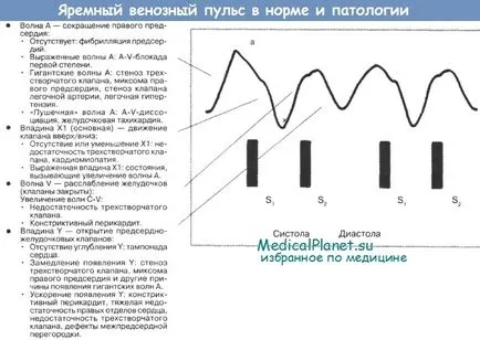 Як виміряти центральний венозний тиск (ЦВТ) при огляді (як виміряти центральний венозний тиск) Як виміряти центральний венозний тиск (ЦВТ) при огляді