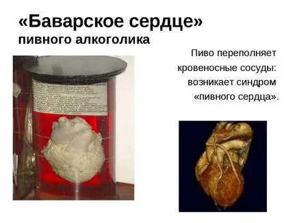 Як пиво впливає на серце і який його шкода для судин (пиво) Як пиво впливає на серце і який його шкода для судин
