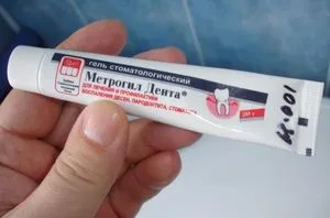 Як застосовувати метрогил дента при стоматиті інструкція, відгуки (метрогил від стоматиту) Як застосовувати метрогил дента при стоматиті інструкція, відгуки