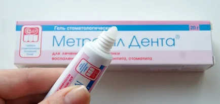 Як застосовувати метрогил дента при стоматиті інструкція, відгуки (гель від стоматиту метрогил) Як застосовувати метрогил дента при стоматиті інструкція, відгуки