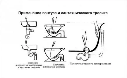 Як прочистити унітаз від засмічення пляшкою, содою, тросом (засмічення) Як прочистити унітаз від засмічення пляшкою, содою, тросом