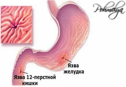 Як впливає алкоголь на організм людини (алкоголь) Як впливає алкоголь на організм людини