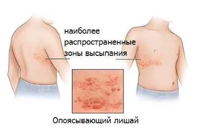 Діагностика і лікування позбавляючи у вашої дитини