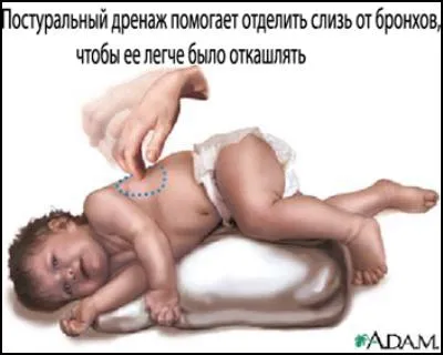 Як змусити дитину відкашлювати мокротиння