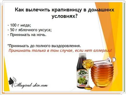 Кропив'янка заразна чи ні для оточуючих