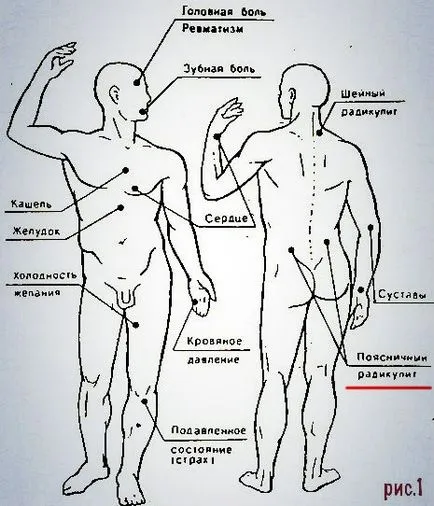 Купити манжет be active від радикуліту