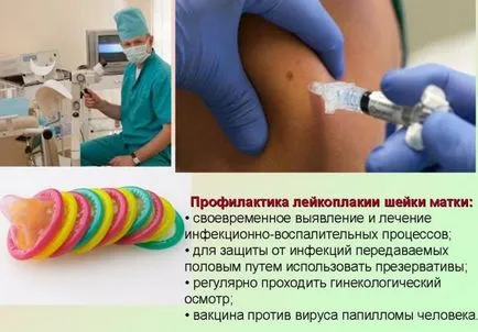 Лейкоплакія шийки матки лікування - припікання, видалення за допомогою лазера, операція, народні методи (шийки) Лейкоплакія шийки матки лікування - припікання, видалення за допомогою лазера, операція, народні методи