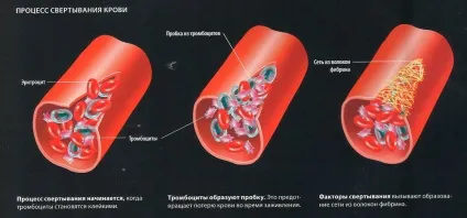 Чому кров не згортається