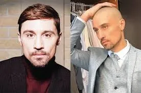 Діма білан живий чи ні, що з ним сталося, чому лисий і худий (трапилося) Діма білан живий чи ні, що з ним сталося, чому лисий і худий