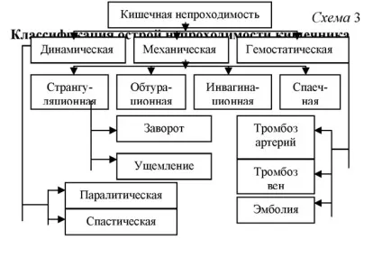 Динамічна кишкова непрохідність причини, лікування (причини) Динамічна кишкова непрохідність причини, лікування