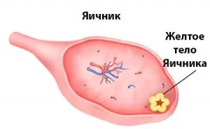 Лютеиновая кіста лівого яєчника особливості розвитку і методи лікування новоутворення