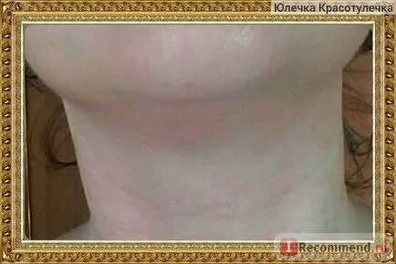 Масажні банки чудо-банку - «як швидко прибрати друге підборіддя за два тижні і підтягнути овал (другий) Масажні банки чудо-банку - «як швидко прибрати друге підборіддя за два тижні і підтягнути овал