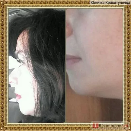 Масажні банки чудо-банку - «як швидко прибрати друге підборіддя за два тижні і підтягнути овал (підборіддя) Масажні банки чудо-банку - «як швидко прибрати друге підборіддя за два тижні і підтягнути овал