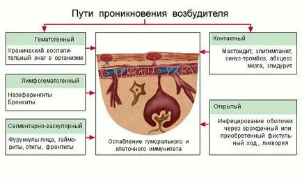 Менінгіт етіологія, патогенез, симптоми, діагностика, клініка, лікування (інфекційні хвороби) Менінгіт етіологія, патогенез, симптоми, діагностика, клініка, лікування