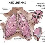 Мотивації які допоможуть кинути палити (які) Мотивації які допоможуть кинути палити