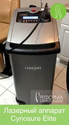чоловіча епіляція