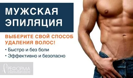 чоловіча епіляція