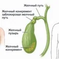 Народне лікування васкуліту