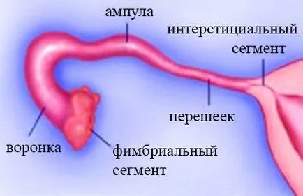 Непрохідність маткових труб лікування, діагностика і причини виникнення (ознаки непрохідності маткових труб) Непрохідність маткових труб лікування, діагностика і причини виникнення