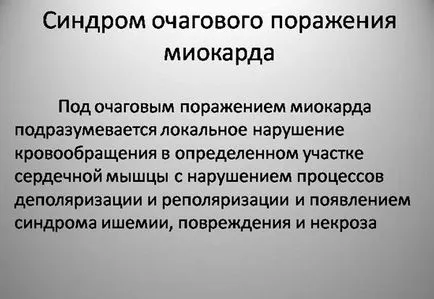 Вогнищевий інфаркт міокарда - великий, причини, симптоми, лікування, дифузний (інфаркт) Вогнищевий інфаркт міокарда - великий, причини, симптоми, лікування, дифузний