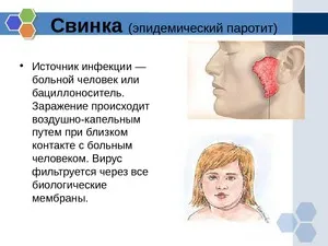 Основні характеристики епід або вірусного паротиту, його симптоми, ускладнення та методи лікування у (вірусного) Основні характеристики епід або вірусного паротиту, його симптоми, ускладнення та методи лікування у