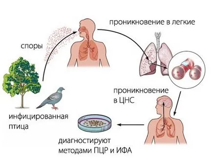 Орнітоз - причини, ознаки, симптоми і лікування пситтакоза (лікування) Орнітоз - причини, ознаки, симптоми і лікування пситтакоза